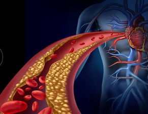 (血蝶图片)血蝶是身体哪个部位?探究身体内脏结构与功能的奥秘 (血蝶图片)血蝶是身体哪个部位?探究身体内脏结构与功能的奥秘